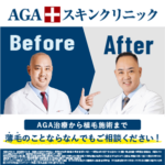 AGAスキンクリニックバナー