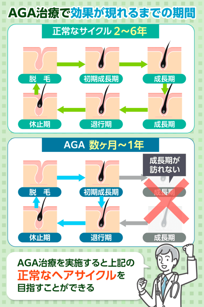 AGAのへサイクルに関する画像