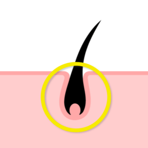 AGA治療予防プランのアイコン