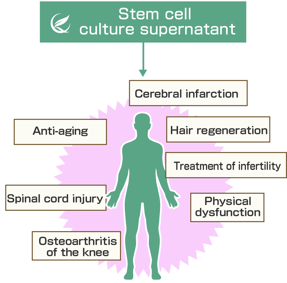 Denver Stem Cell Therapy
